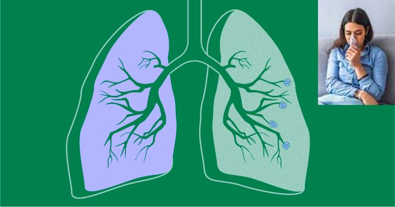  WORLD COPD DAY How to manage the disease, improve quality of life