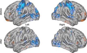 Brain functional connectivity