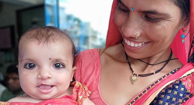 National Cleft Day is observed on February 8 every year