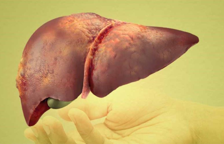  ‘India making significant progress in liver disease treatment’