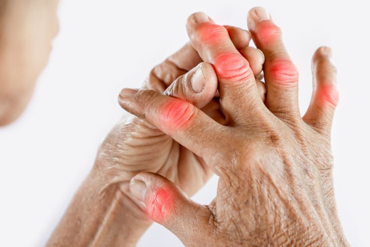  World Arthritis Day: A Holistic Approach to Arthritis with Homeopathy