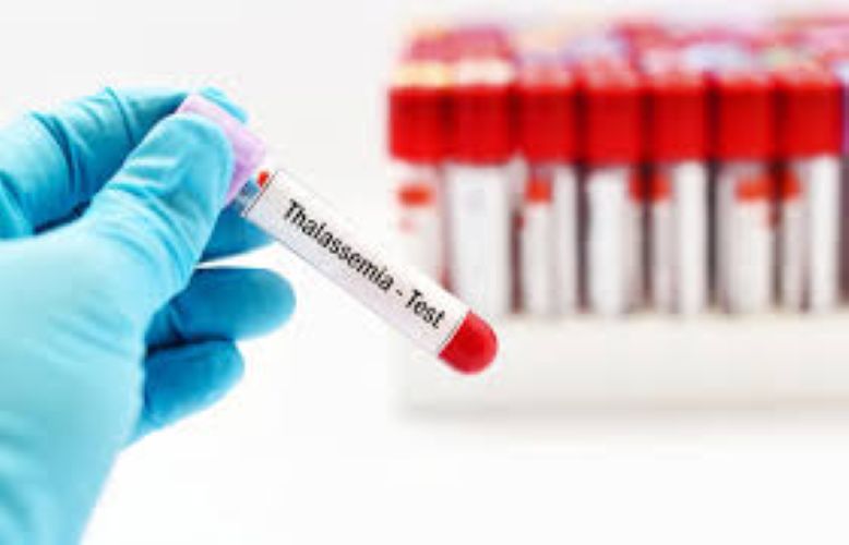  World Thalassaemia Day: Concern over access to care