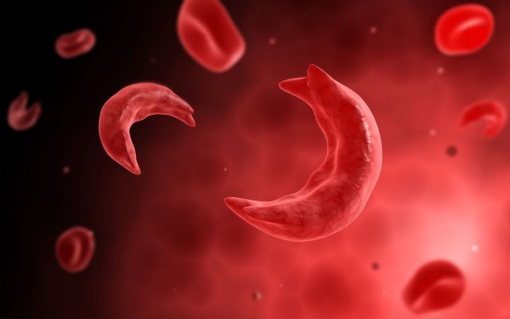  Gene Therapy and Rapid Test Lead India’s Fight Against Sickle Cell Anaemia