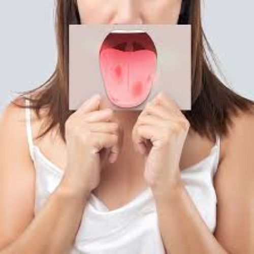  Surge in Oral Cancer among young Indians