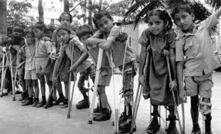 Doctors call for maintaining surveillance against polio cases in country