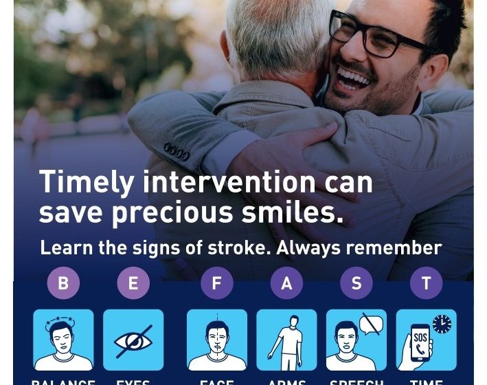 STROKES YOU DIDN’T KNOW EXISTED