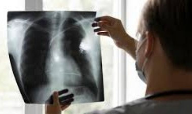  Rising pneumonia concerns in Mumbai